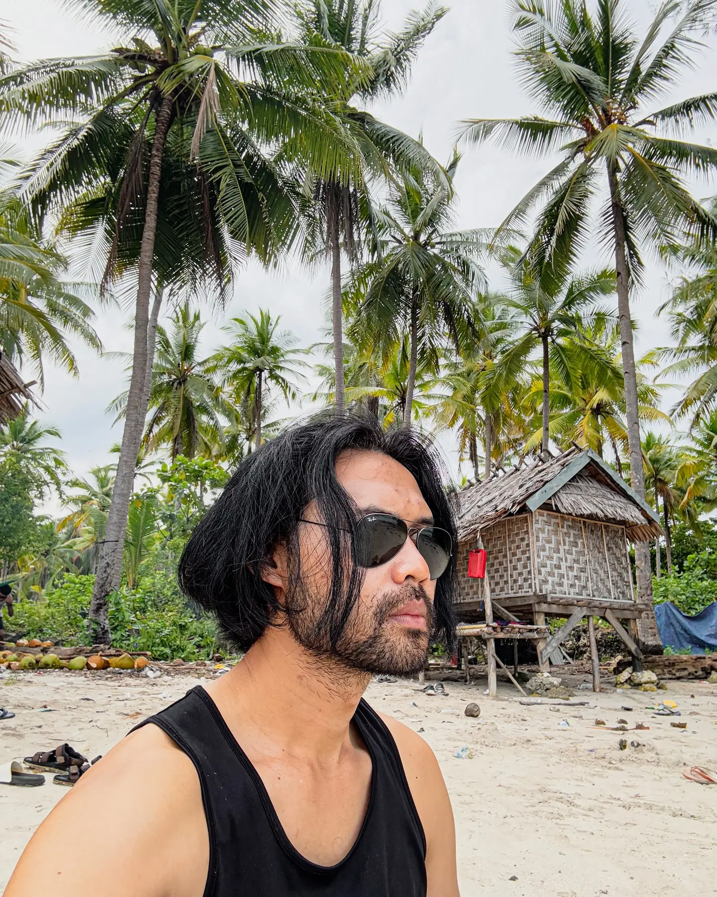 Adhin’s Island Update: Skin Saga Unfolds Adhin Abdul Hakim shares his raw island story and his battle with sun damage uniquely! Yay