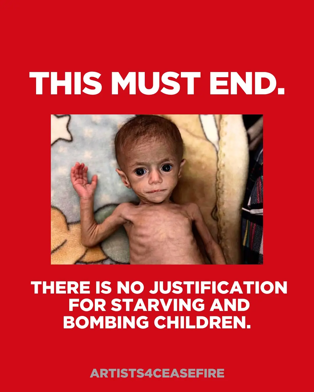 Gaza Crisis: Children's Lives At Risk