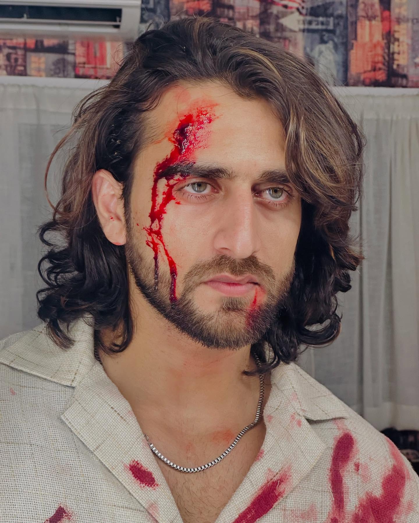 Zayn Ibad Khan's On-Screen Injuries Unveiled