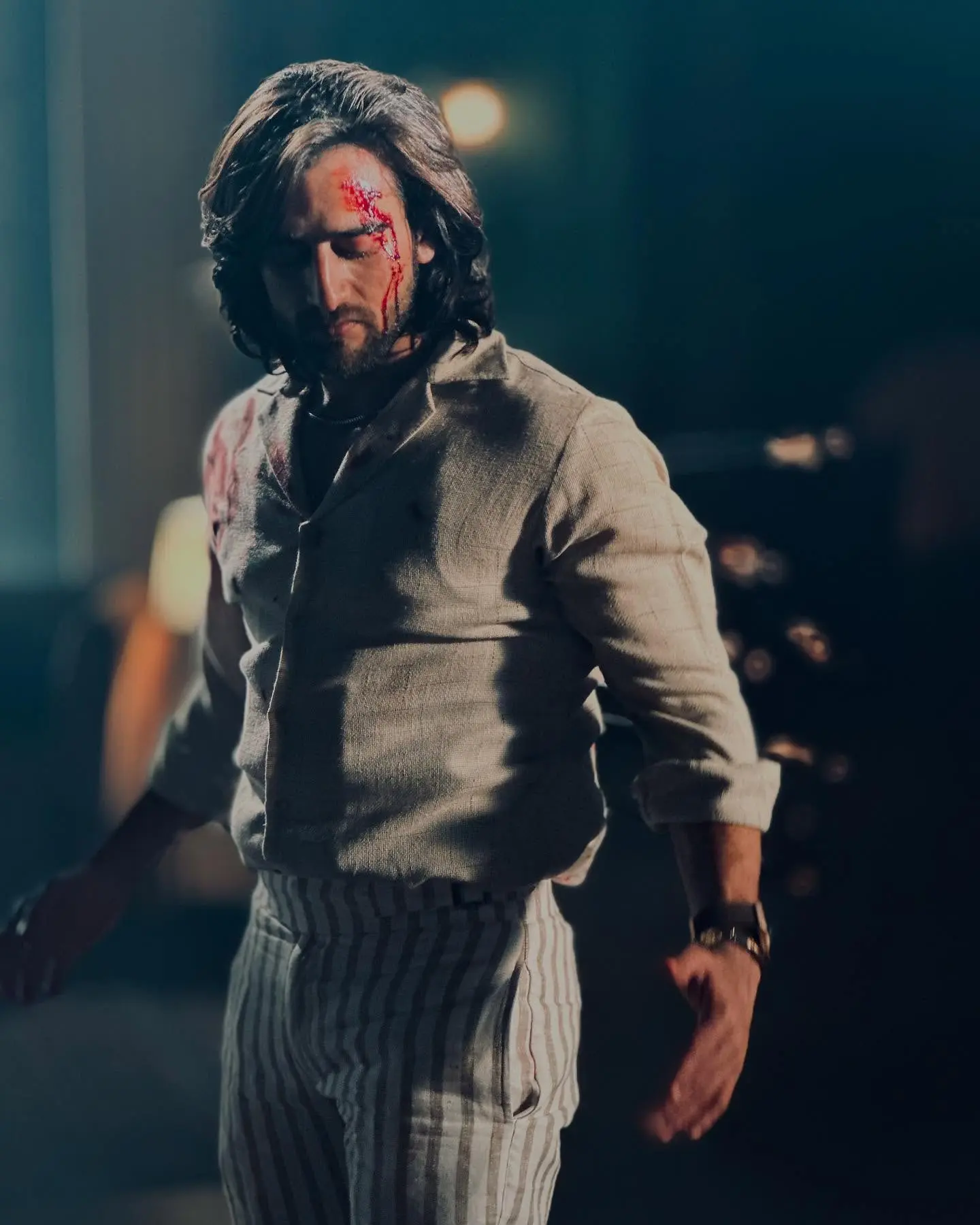 Zayn Ibad Khan's On-Screen Injuries Unveiled