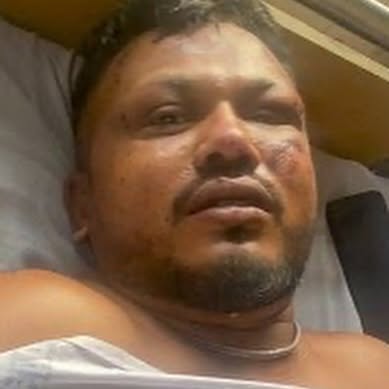 Plane Crash Survivor Speaks Out